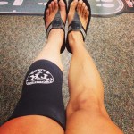 One day post injury. Swollen much?